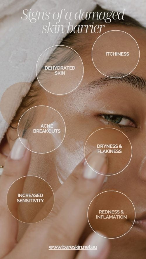 Is your skin barrier impaired?